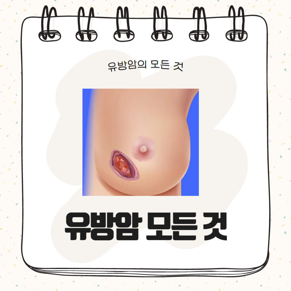 유방암의 모든것 - 유방암 원인, 초기증상, 병기, 생존율, 치료, 검사, 수술, 예방법 관련 참고 이미지 1