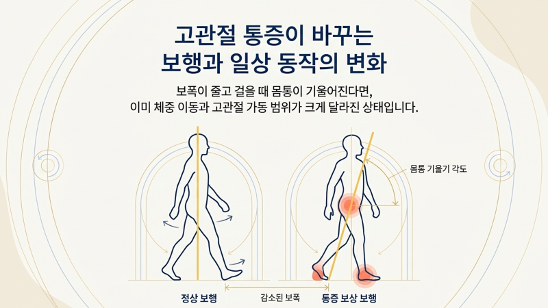 고관절 통증과 수면의 연관성을 설명하는 본문 사이의 슬라이드 이미지