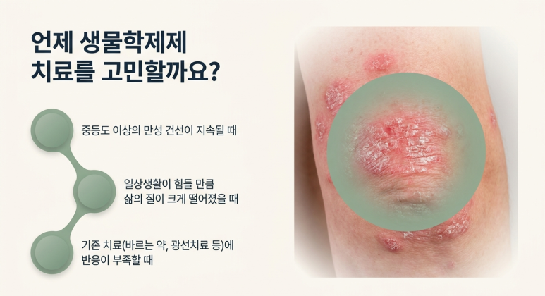 건선 생물학제제 치료를 고민하기 전 확인할 질문 관련 이미지 2