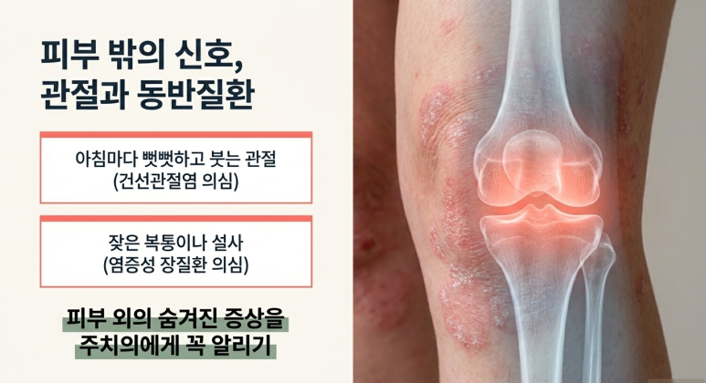 건선 생물학제제 치료를 고민하기 전 확인할 질문 관련 이미지 9
