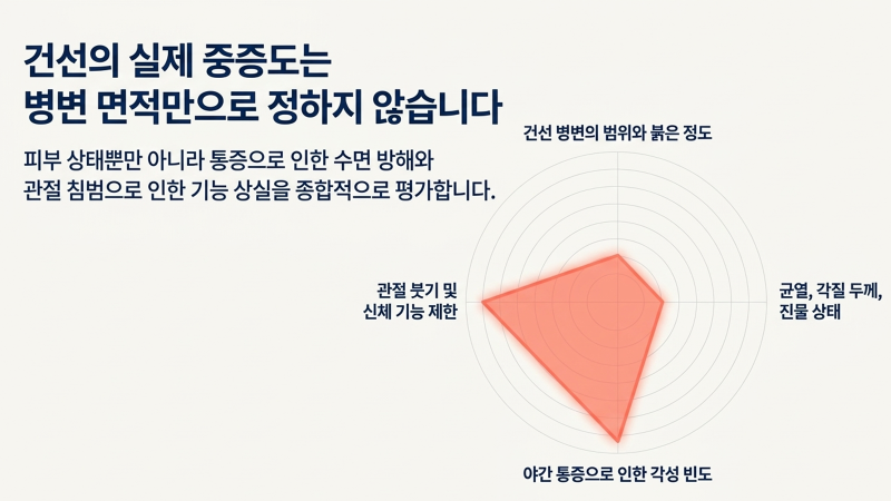 처음 잠이 흔들릴 때 확인할 수 있는 초기 피부 증상과 자극을 줄이는 방법을 설명하는 슬라이드 이미지입니다.